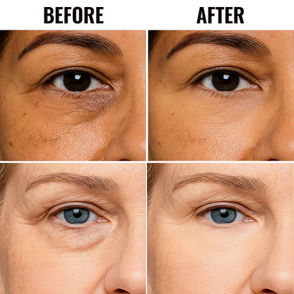 ✨ LAST DAY PROMOTION - BUY 2 GET 1 FREE✨ UNDER EYE BRIGHTENER